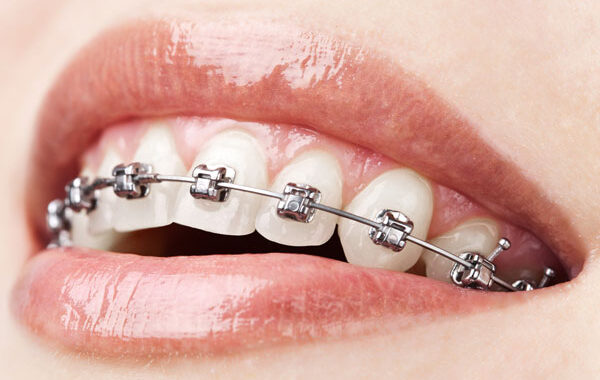 3 Dental Treatments You Should know About