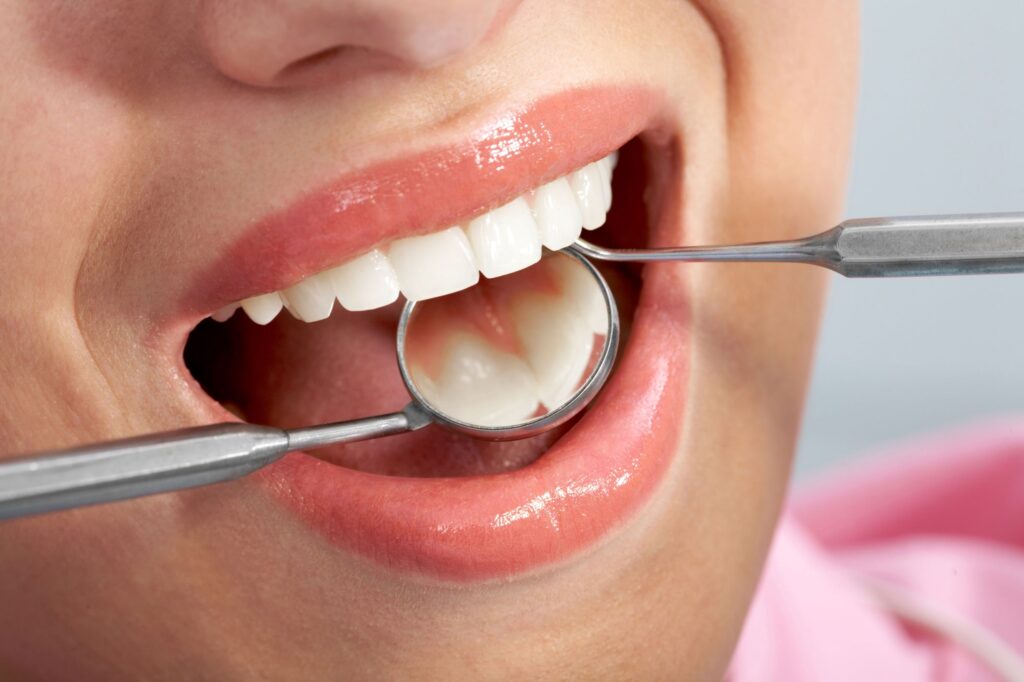 Choosing the Suitable Cosmetic Dental Procedure – Things to Keep in Mind 