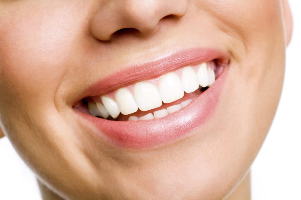 What is the most effective method of teeth whitening?