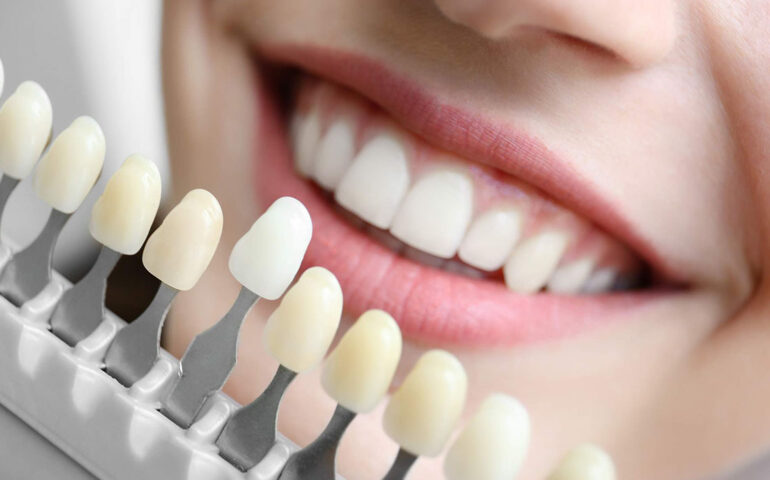 Types of Cosmetic Dentistry Procedures To Fix Your Teeth 
