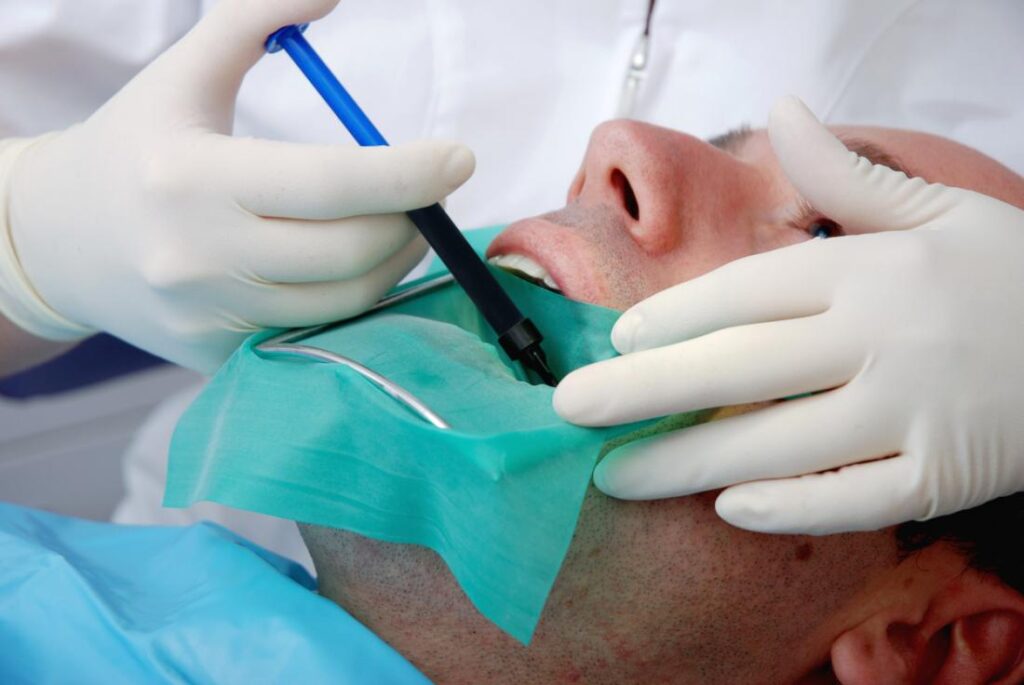 Top 4 Symptoms for Possible Root Canal Therapy