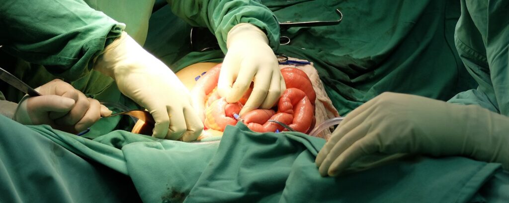 What is Colorectal Surgery?
