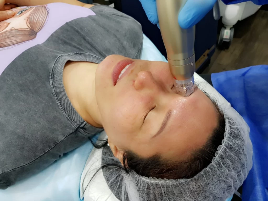 Sylfirm X: How Does This Skin Tightening Treatment Work?