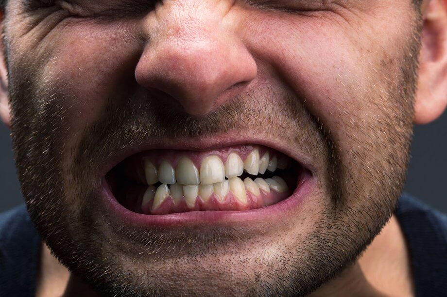 Effective Ways to Overcome Teeth Grinding