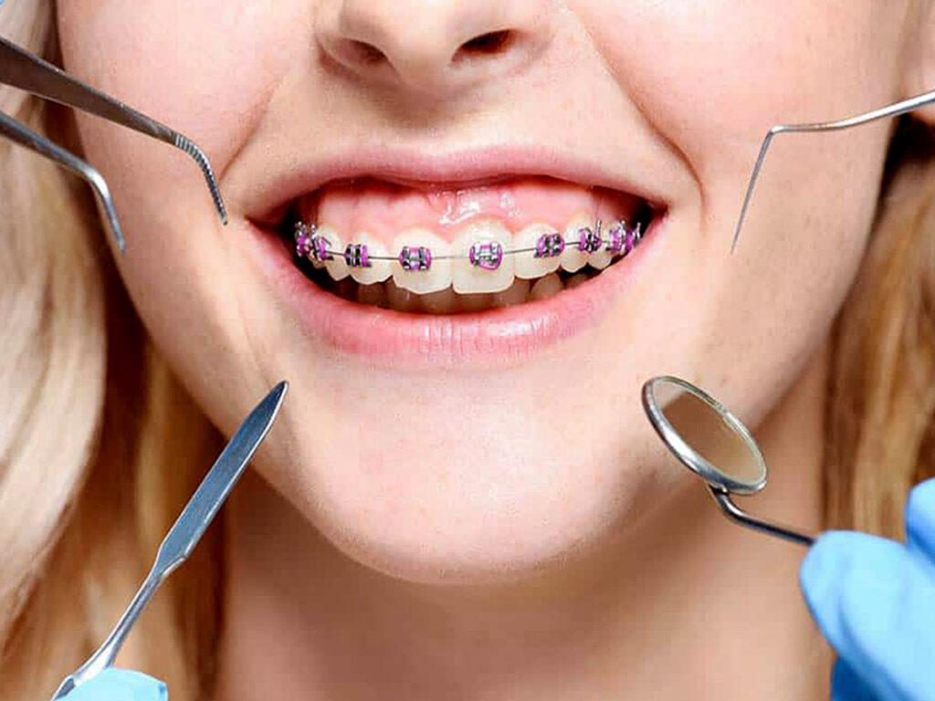 Understanding Different Dental Treatments Available