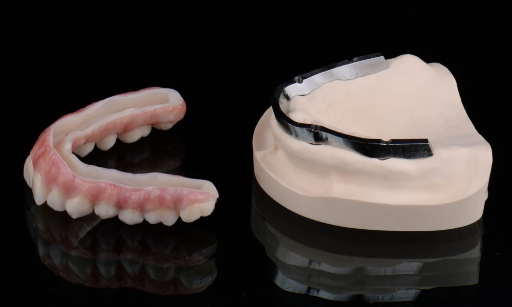 10 Reasons Patients Choose Zirconia Over Acrylic for Full-Arch Teeth: Insights From Stubbs Dental and Other Utah Providers