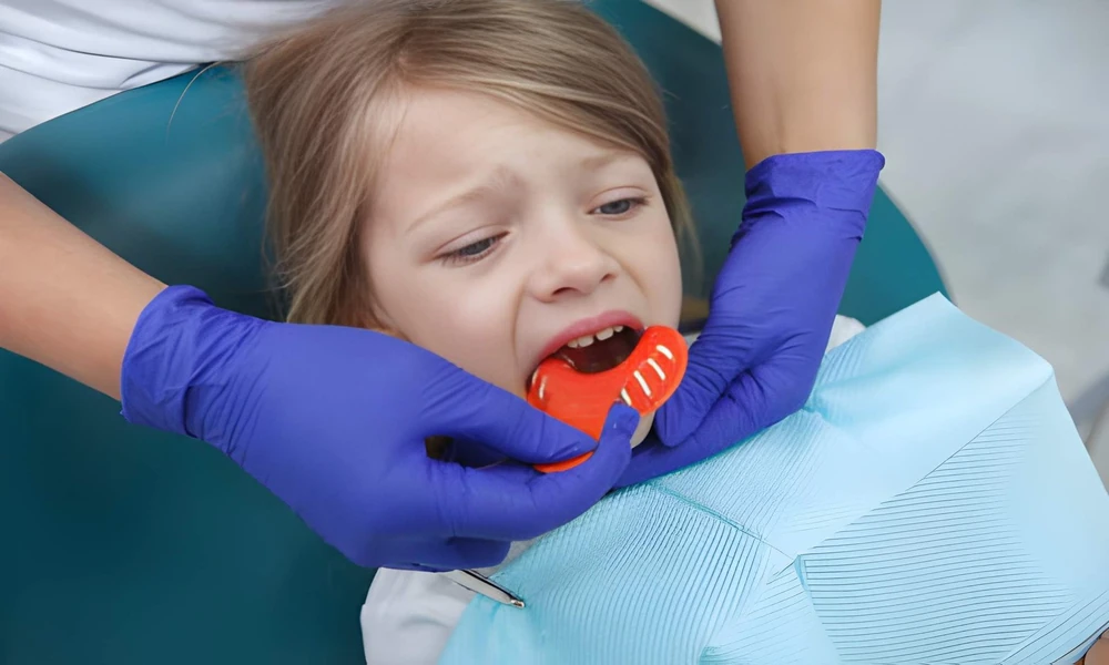 Signs Your Child May Need a Palatal Expander